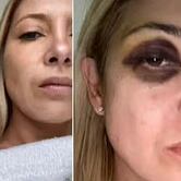 Escándalo en Argentina: Ex esposa del expresidente, Alberto Fernández, dijo que está destruida