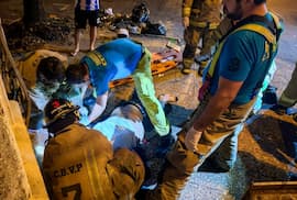 Asunción: motociclista sufre fracturas tras chocar contra un auto