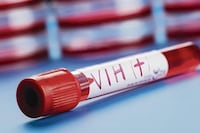Salud diagnostica cuatro casos de VIH por día y la mayoría son jóvenes de entre 20 y 34 años