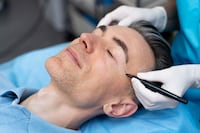 Rinoplastia vs. rinomodelación: claves para elegir el cambio ideal