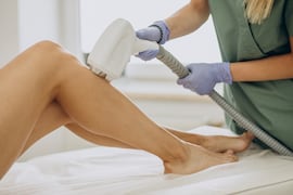 Radiofrecuencia corporal: el tratamiento que mejora nuestra piel y reduce celulitis