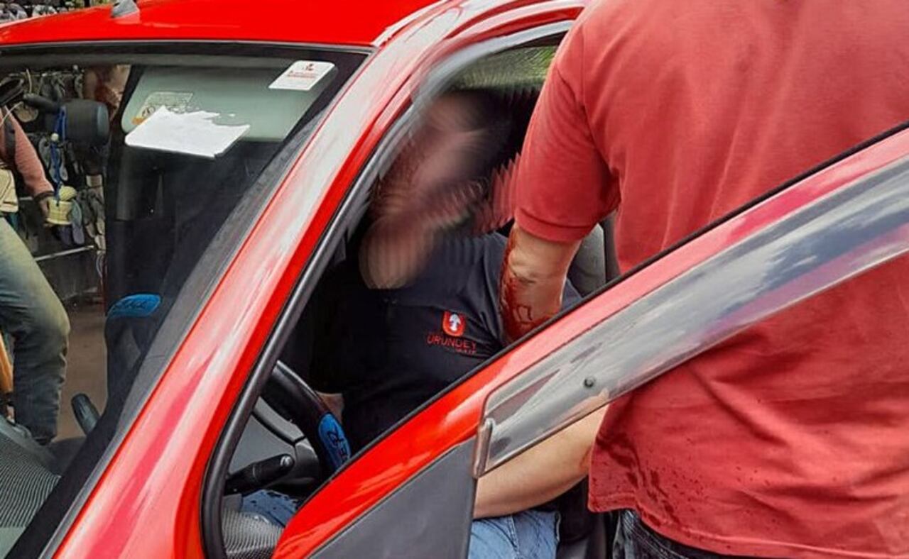 Así quedó el periodista, Alexander Alvarez, luego del atentado. Foto: Radio 1° de Marzo.