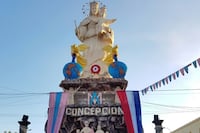 Oftalmólogos impulsan asistencia médica gratuita en Concepción