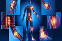 Fibromialgia: 340.000 paraguayos sufren este mal invisible y crónico